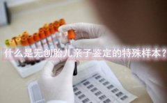 什么是无创胎儿亲子鉴定的特殊样本？