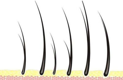 剪下来的头发可以做亲子鉴定吗