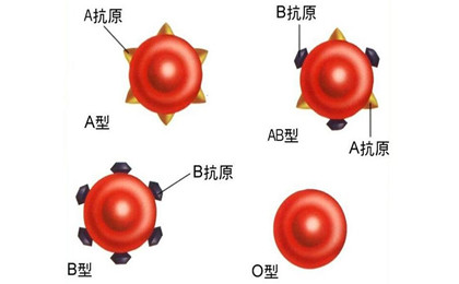 各种各样ABO血型能表明问題吗？血型鉴定误差较为大