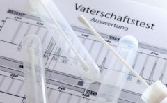 揭阳做司法亲子鉴定等结果要多久?